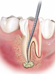 Endodonzia1-271x300